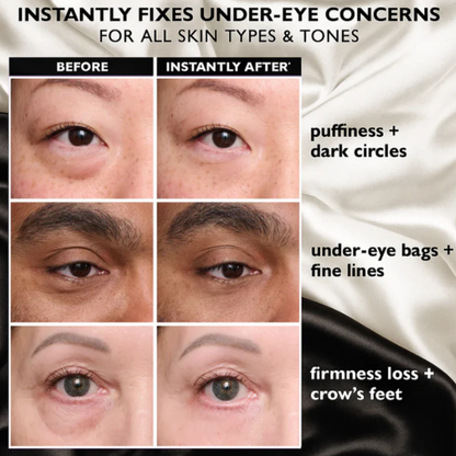 Temporary Eye Tightener