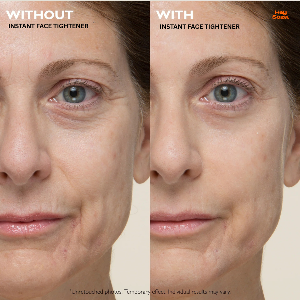 Temporary Face Tightener