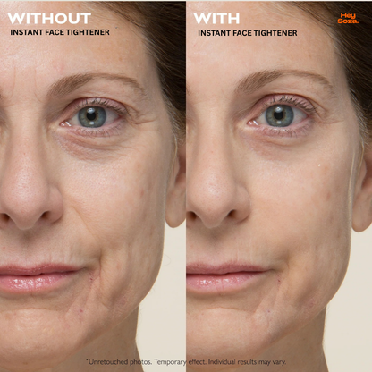 Temporary Face Tightener