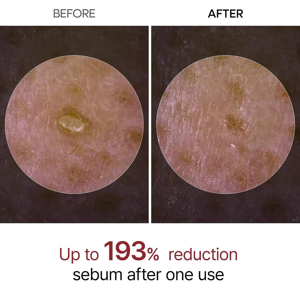 Radiant Rice Peel Ampoule
