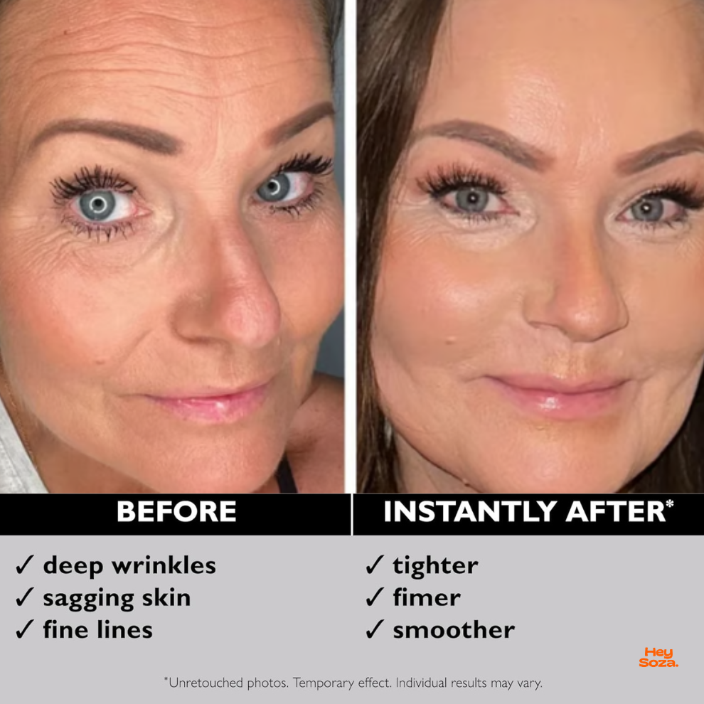 Temporary Face Tightener