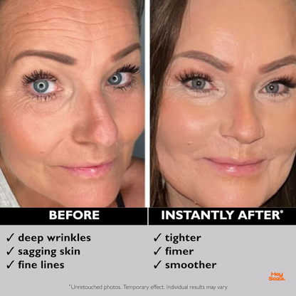 Temporary Face Tightener