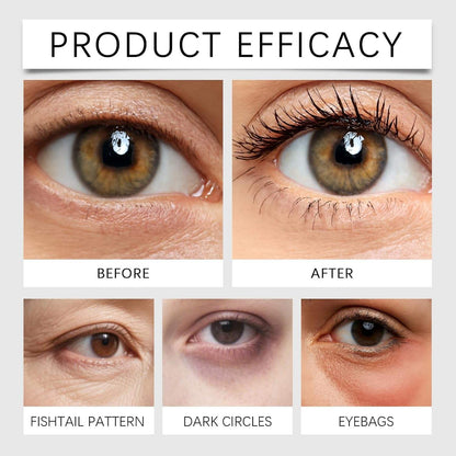 Temporary Eye Tightener